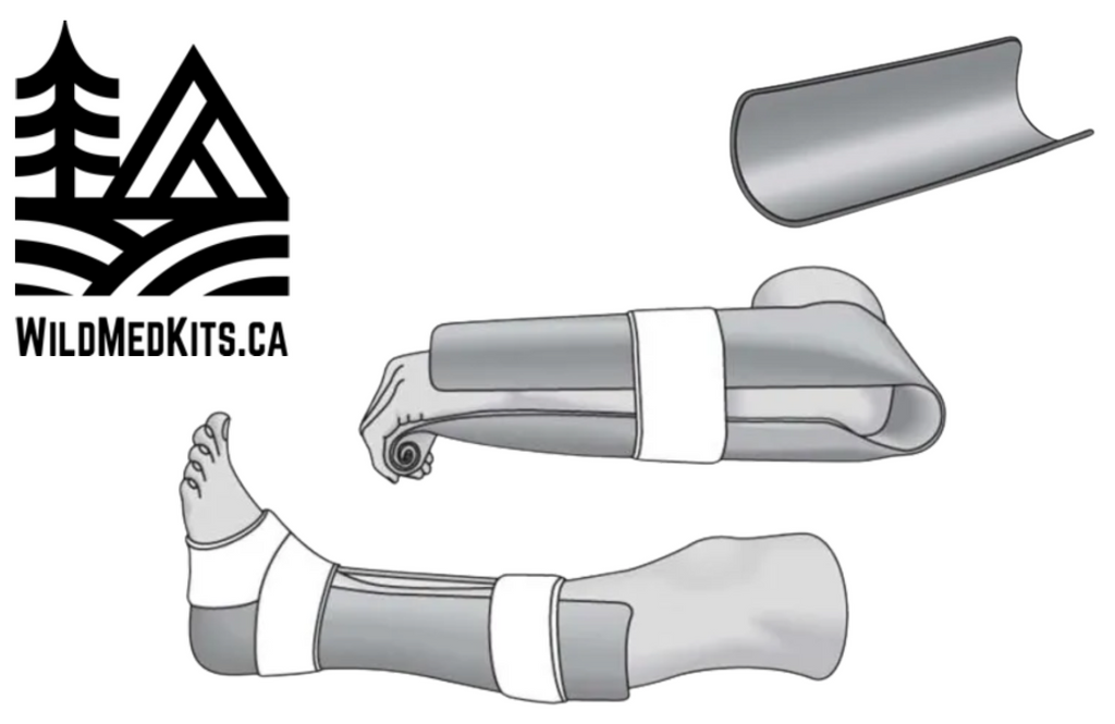 Splinting 101: Immobilizing Bone, Muscle, and Joint Injuries