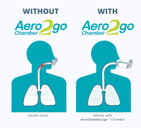 Aero2Go: Portable Aerochamber MDI Spacer