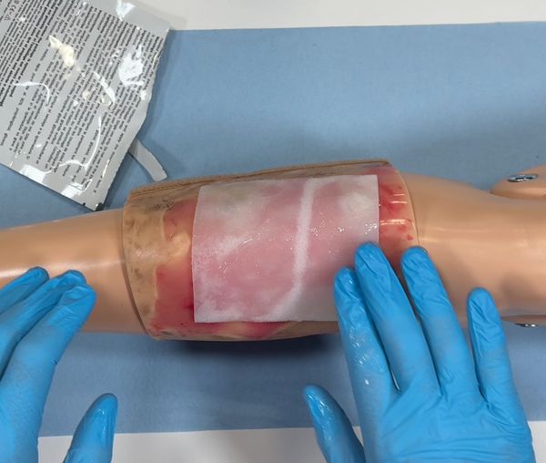 Hydrogel Burn Dressing, 4"x4"