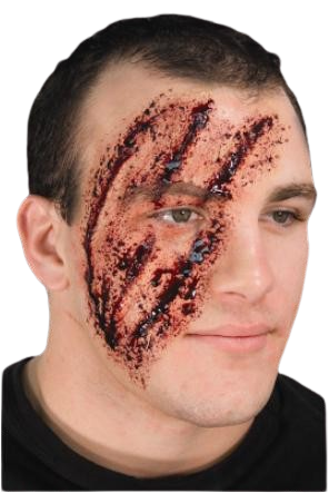 Animal Attack Multiple Slash Wound: Casualty Simulation