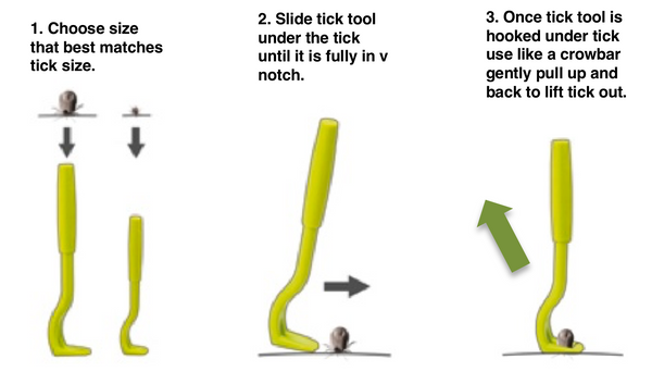 Tick Removal Tool set (2)